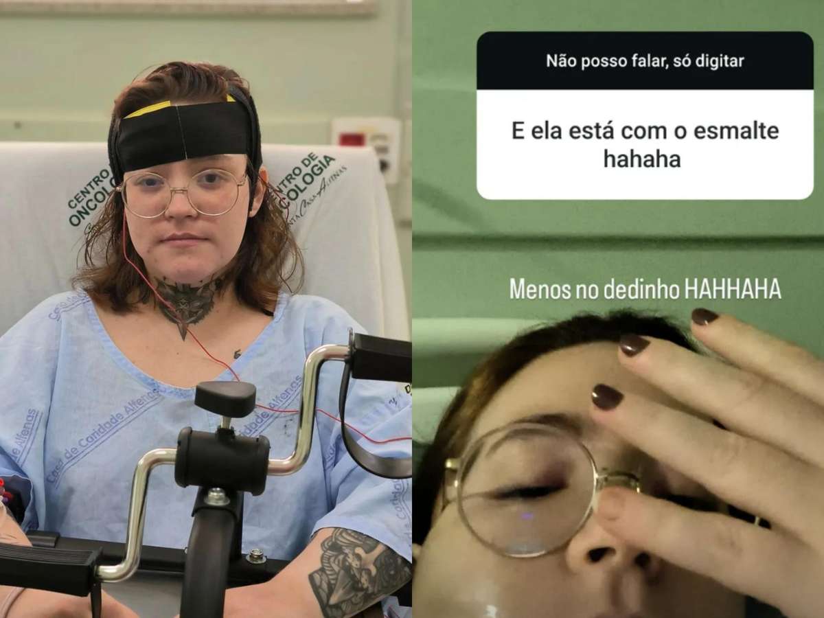 unha de gel e anestesia
