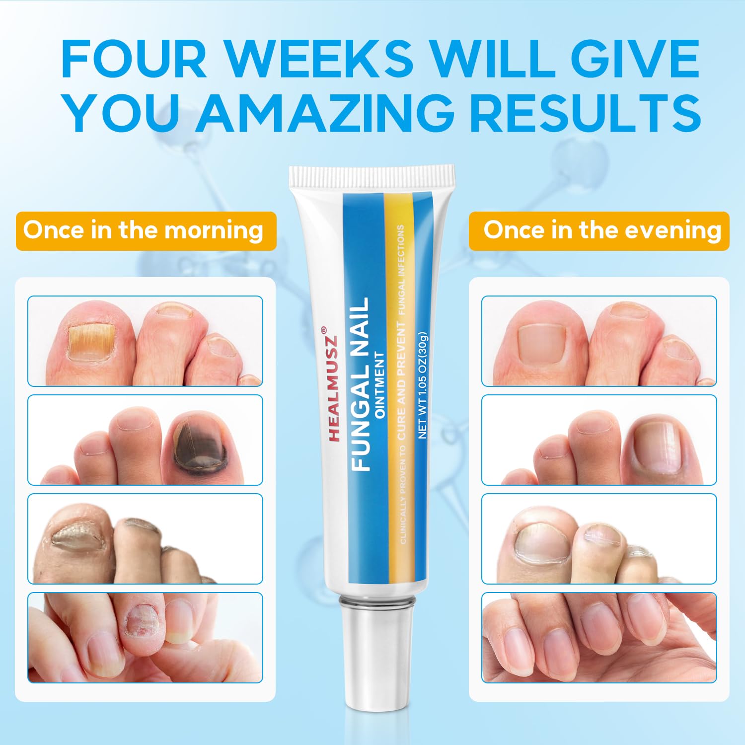 pomada para fungos na unha