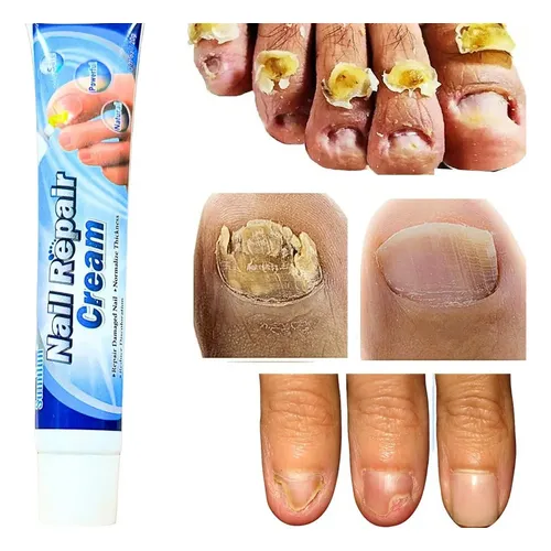fortalecedor de unhas quebradiças