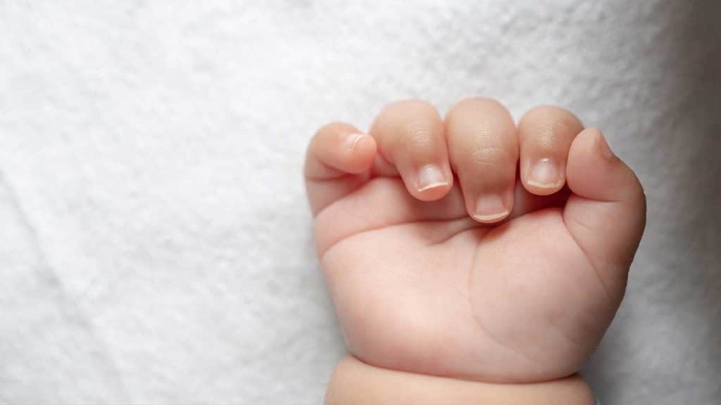 Mitos e verdades sobre unha encravada em recém-nascidos