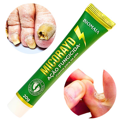 Como identificar se sua unha inflamada tem pus ou micose?