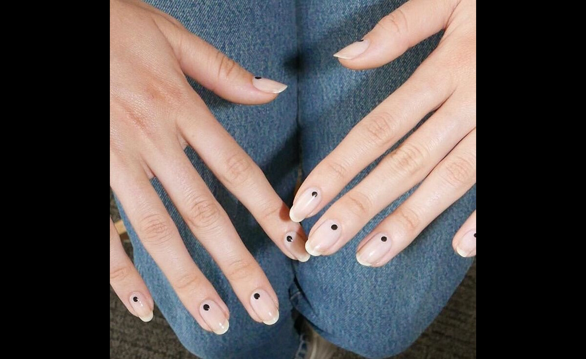 Melanoníquia: O que é, Causas e Quando se Preocupar