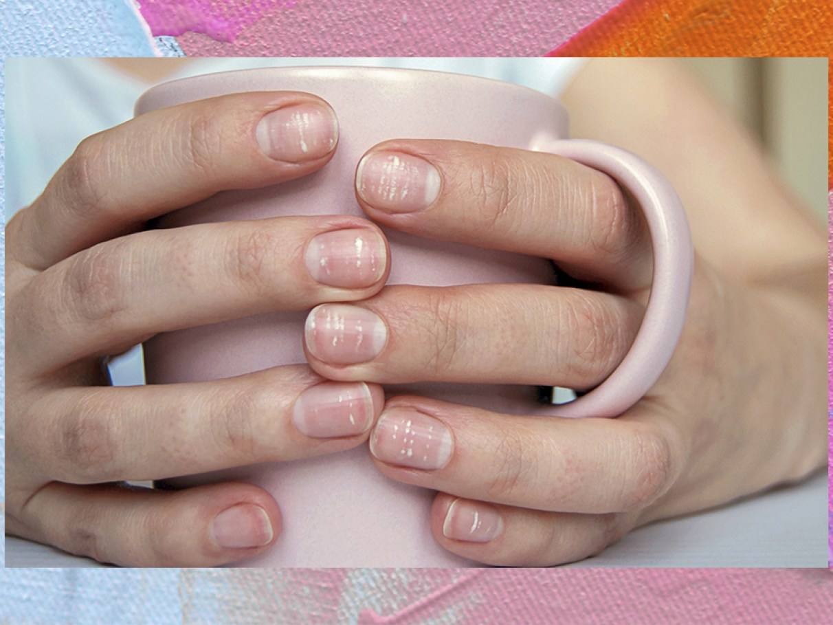 porque a unha fica branca