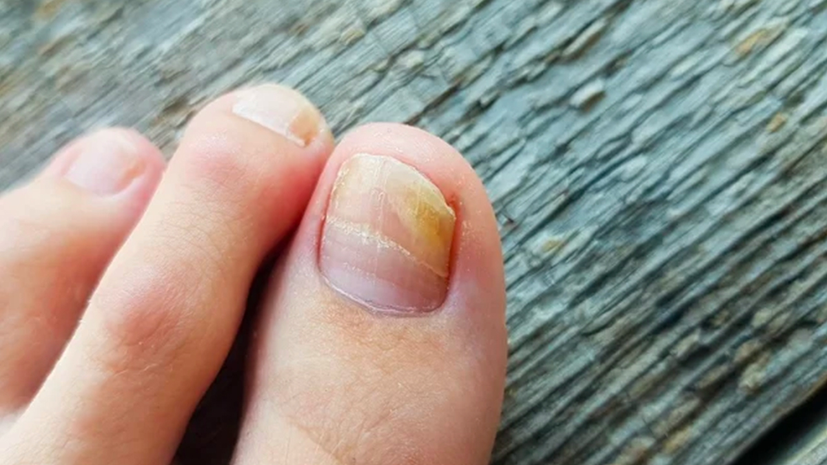 melhores bases para unhas amareladas