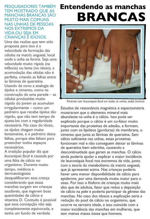 manchas brancas nas unhas o que pode ser