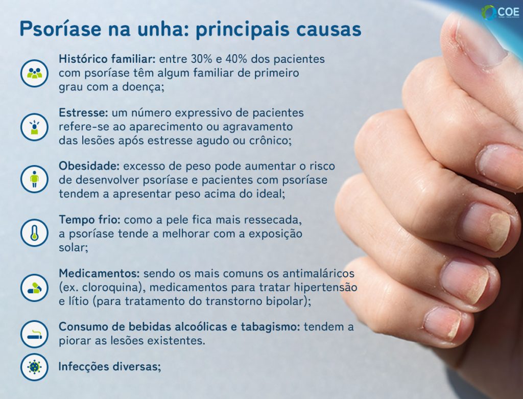 psoríase nas unhas tratamento