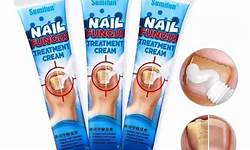 qual a melhor pomada para unha inflamada