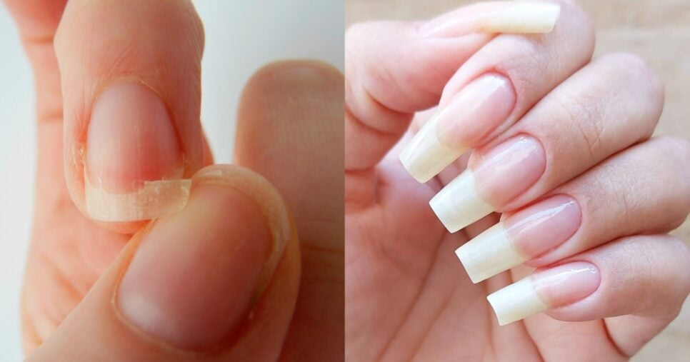 crescimento rápido de unhas