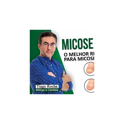 Vinagre de Maçã na Micose: Como Usar e Benefícios