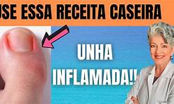 Guia Completo: Como Cortar as Unhas Corretamente para Evitar Inflamação