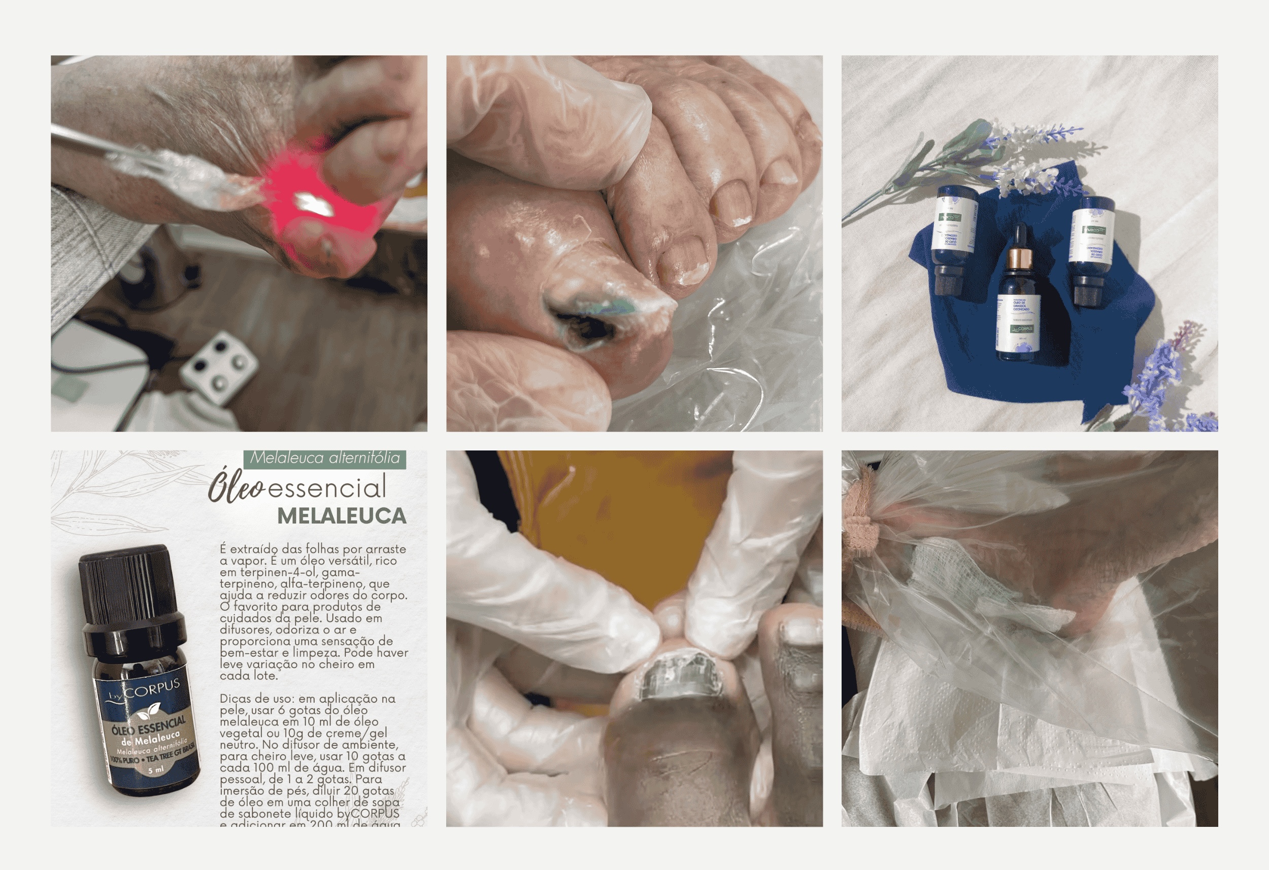 A Importância da Higiene e Prevenção na Luta Contra Fungos nas Unhas