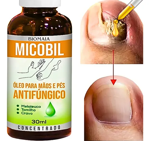 remedio para fungo na unha