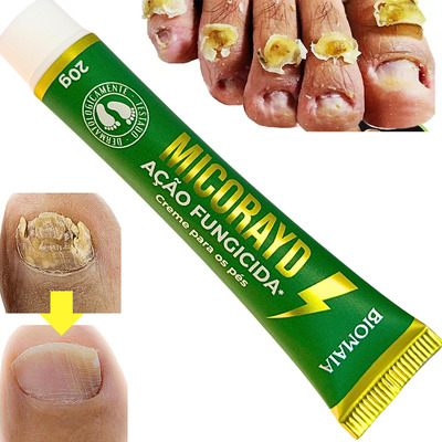 remédio para micose de unha comprimido