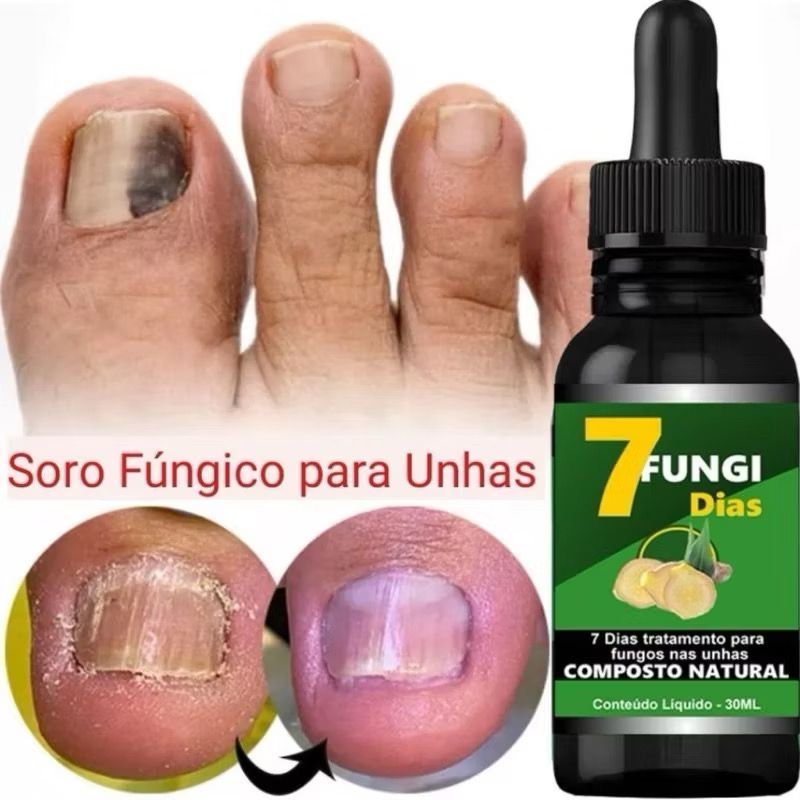 remédio tópico para onicomicose