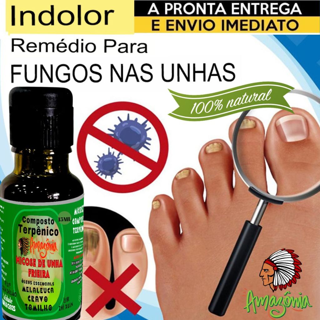 sintomas de fungo na unha