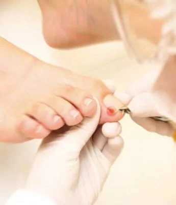 remédio para unha inflamada com pus