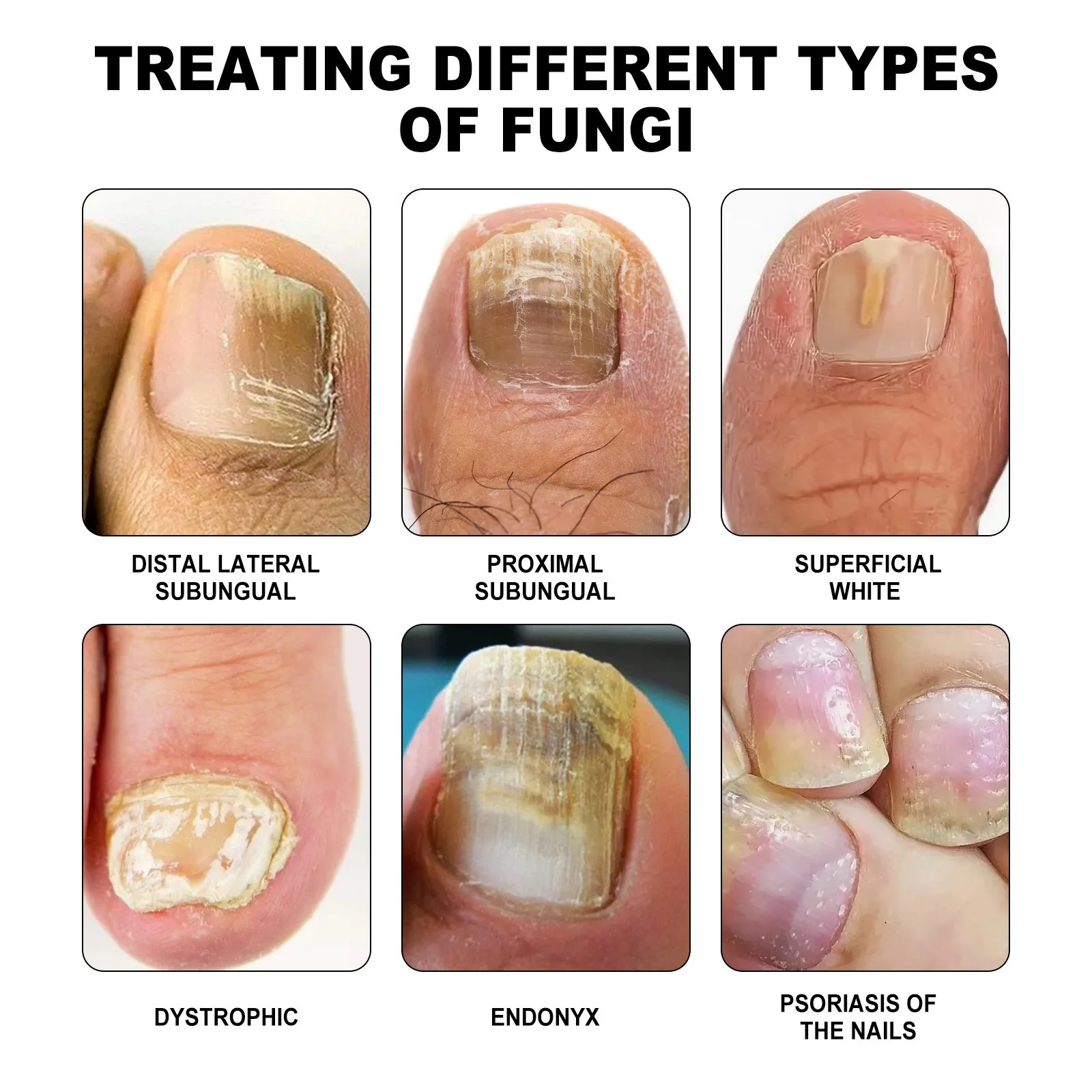 sonhar com unha de outra pessoa vs sonhar com unha própria