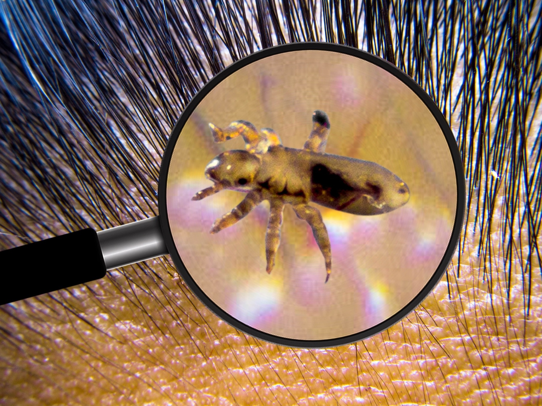 5 ideias de títulos:
1. Sonhar com Piolho: Desvendando os Significados Ocultos
2. O Que Significa Matar Piolhos em Sonhos?
3. Piolhos em Sonhos: Sinais de Alerta ou Superação?
4. A Simbologia do Piolho em Diferentes Contextos Oníricos
5. Sonhos com Piolhos de Cobra: Um Presságio de Perigo?