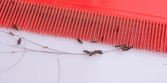 sonhar matando piolho na unha