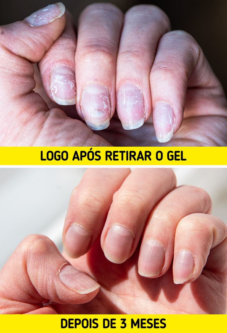 remoção segura de unha de gel