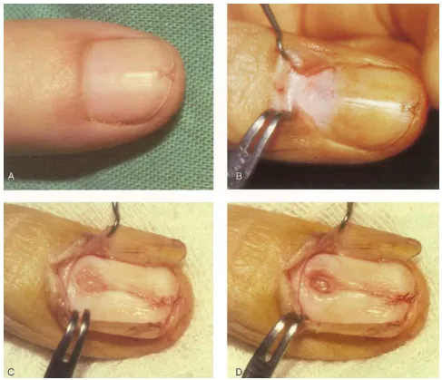 1. O que é o Tumor Glômico e seus Sintomas?
2. Como é feito o Diagnóstico do Tumor Glômico?
3. Opções de Tratamento para o Tumor Glômico
4. Tumor Glômico: Quando Procurar um Especialista?
5. Prevenção e Cuidados com Tumores Glômicos
