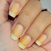 Guia Completo de Bases Desamareladoras: Qual Escolher?