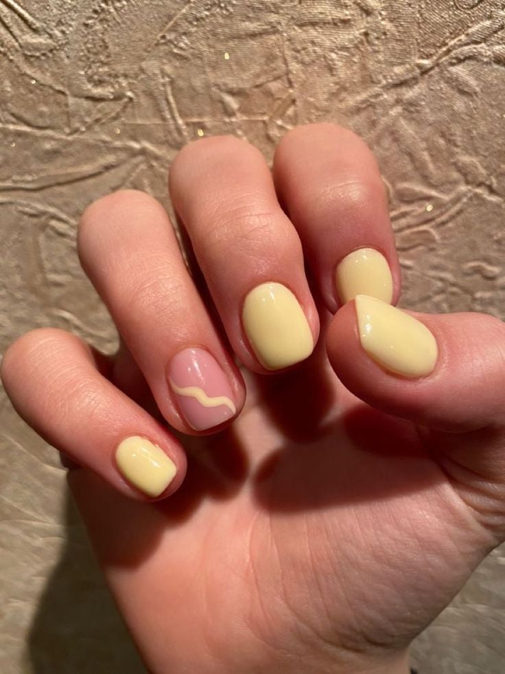 unha amarelada o que pode ser