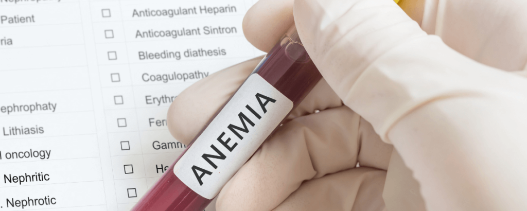 unha anemia ferropriva