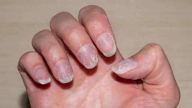 unha opaca após remover esmalte