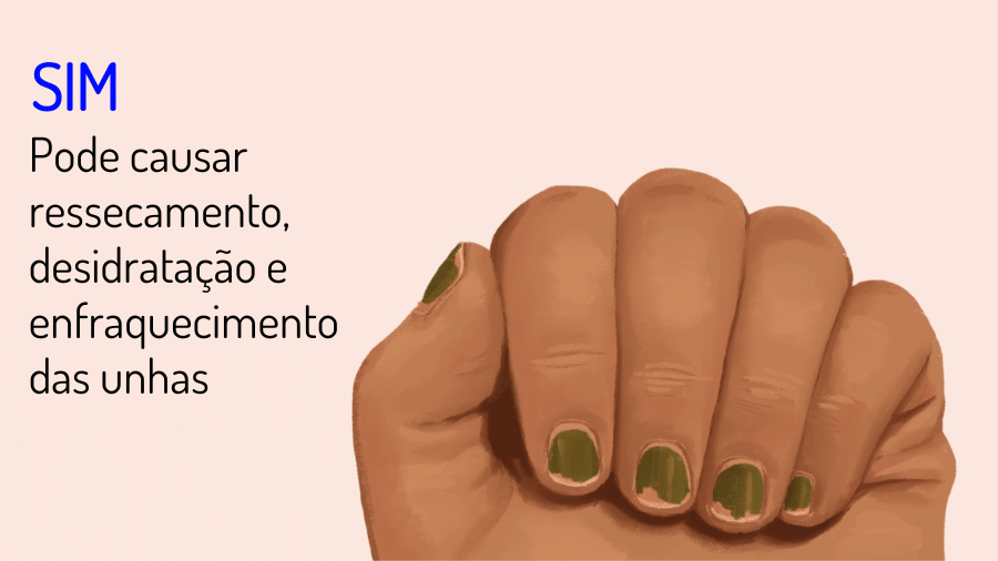 leuconíquia técnica nas unhas