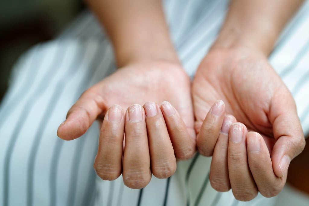 cuidados com unhas após esmaltação contínua