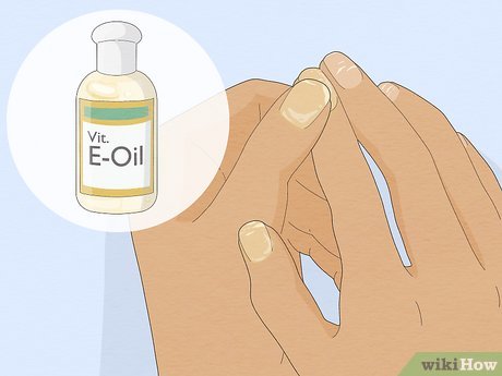 unha com aspecto de giz após tirar esmalte
