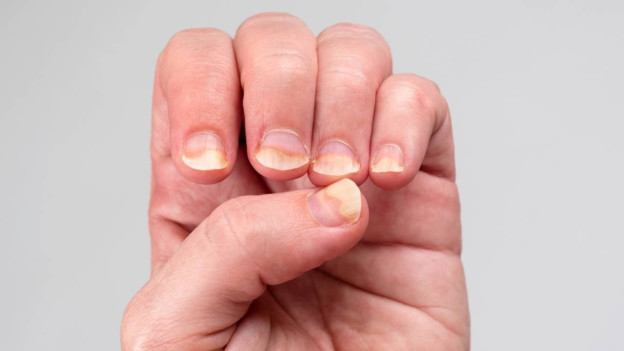 cuidados com a matriz ungueal