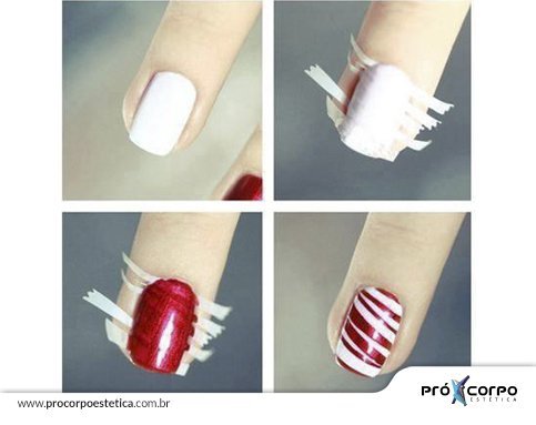 erros comuns ao cuidar de unhas com listras