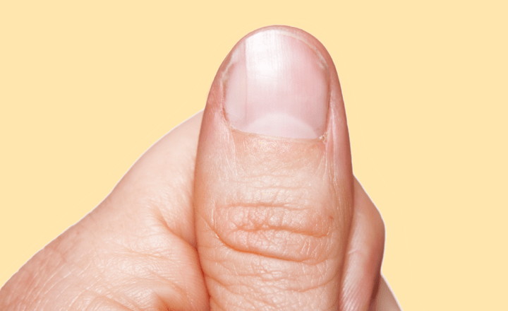 unha com mancha branca