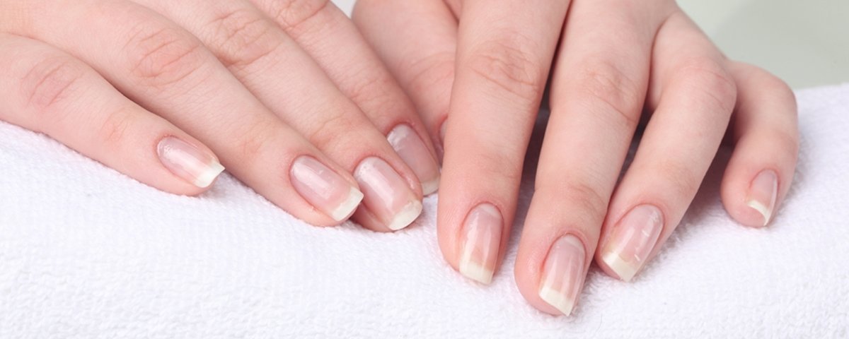 melanoníquia estriada