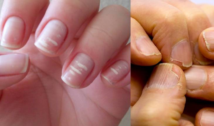nail art 3D