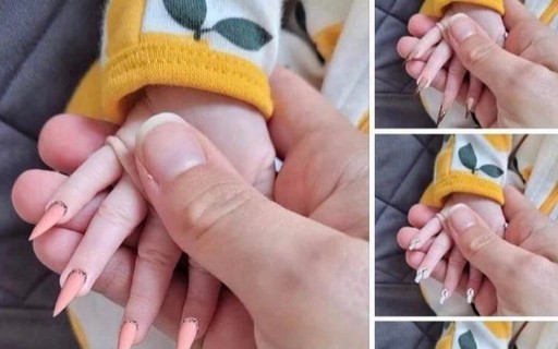 o que fazer se unha de bebe inflamar