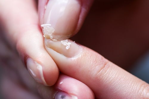 Os Melhores Removedores de Esmalte Sem Acetona para Unhas Frágeis