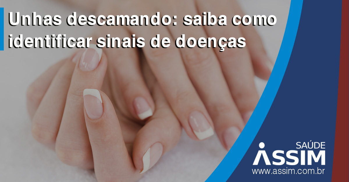 unha descascando e com dor