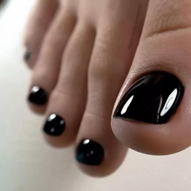 Melanoma de unha: causas, sintomas e a importância do diagnóstico precoce