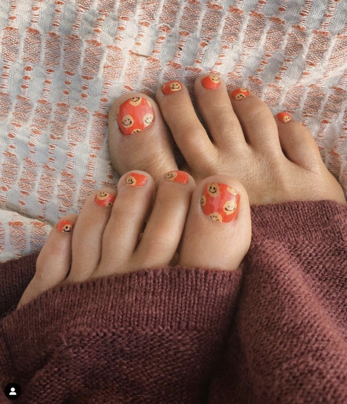 unha do pé encravada