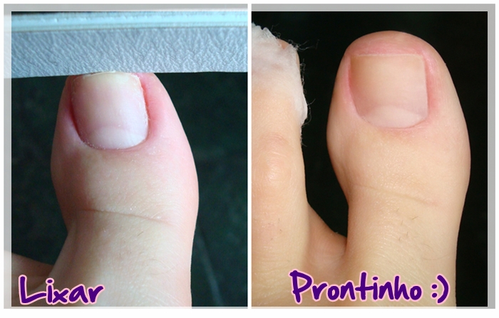 cuidados com os pés