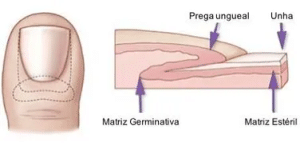 unha do dedo encravada