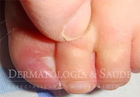 melhores formas de cuidar da unha do bebe