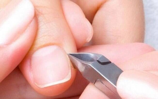 Paroníquia: Como Identificar e Tratar a Inflamação ao Redor da Unha