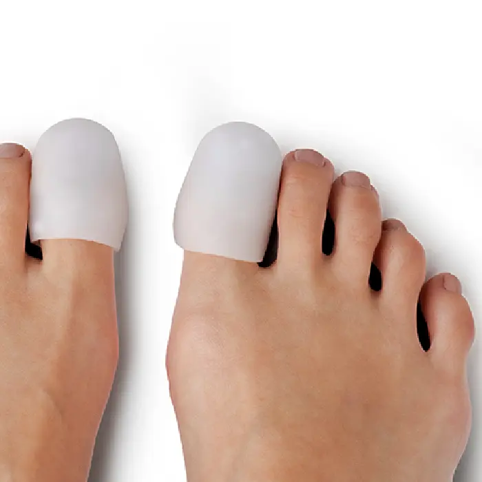 Cantoplastia: O Procedimento Cirúrgico para Unhas Encravadas