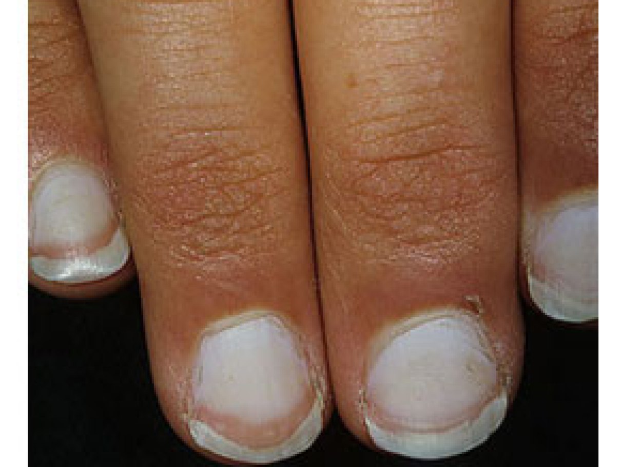 Nutrição e a Saúde das Suas Unhas