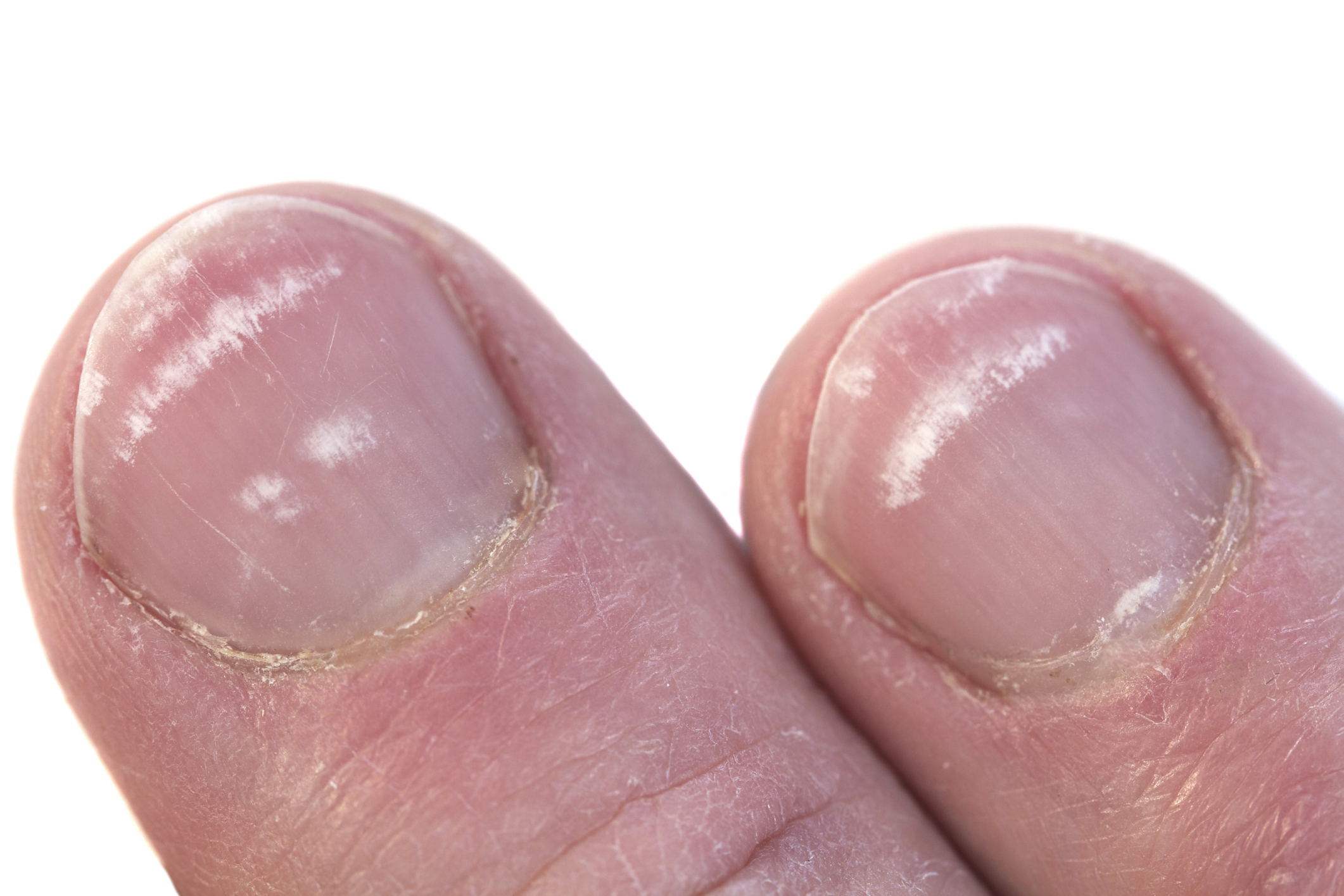 Nutrição e a Saúde das Suas Unhas