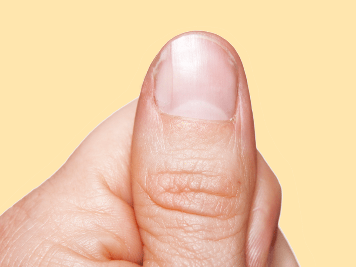 Leuconíquia: Entenda as Causas e Tratamentos para Manchas Brancas nas Unhas; Micose ou Trauma? Desvendando as Manchas Brancas nas Unhas; Guia Completo: Como Prevenir e Tratar Unhas Esbranquiçadas; Quando Procurar um Médico para Manchas Brancas nas Unhas: Sinais de Alerta; A Relação entre Esmaltes